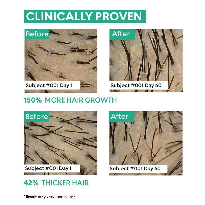 Clinically Proven Hair Growth Serum 50ml
